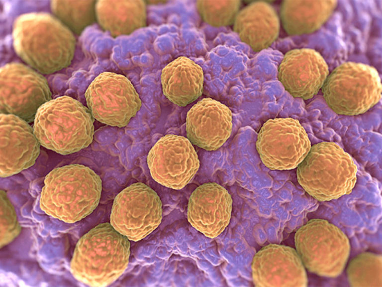 LCSD issues letter regarding nearby measles outbreak